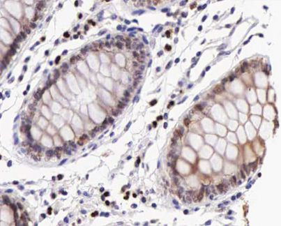 Phospho-IKK beta (Tyr199) Antibody in Immunohistochemistry (Paraffin) (IHC (P))