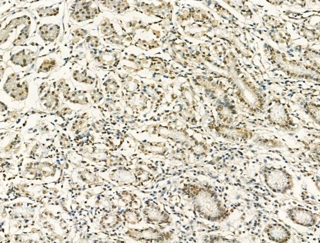 Phospho-JAK2 (Tyr931) Antibody in Immunohistochemistry (Paraffin) (IHC (P))