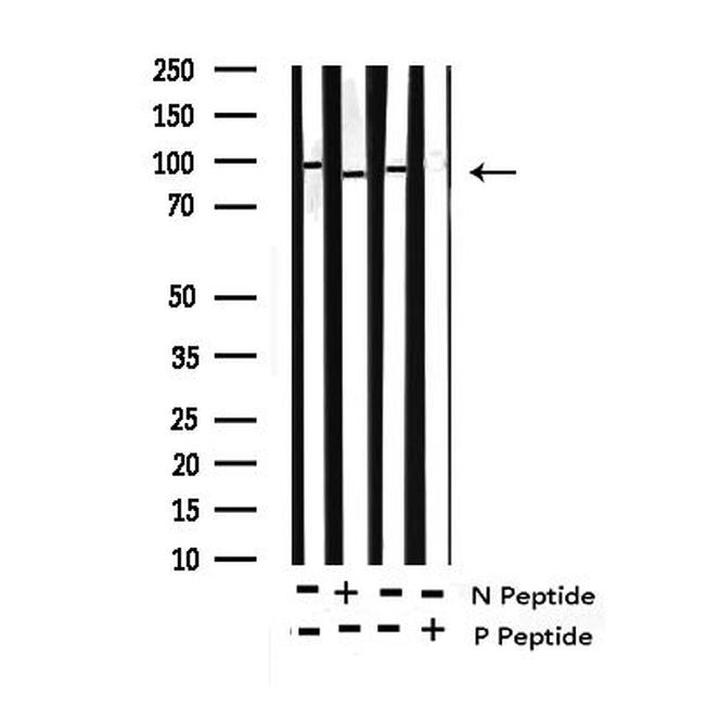 Phospho-NBS1 (Ser343) Antibody in Western Blot (WB)