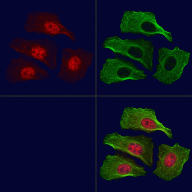 Phospho-MSK1 (Ser376) Antibody in Immunocytochemistry (ICC/IF)