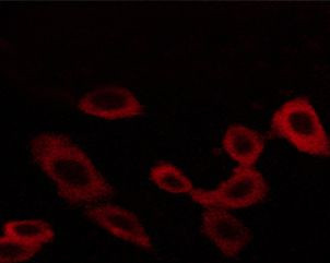Phospho-EGFR (Thr678) Antibody in Immunocytochemistry (ICC/IF)