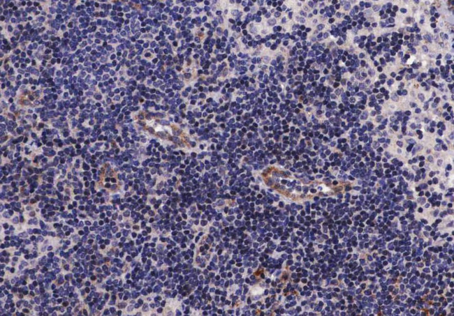 Phospho-EGFR (Ser1070) Antibody in Immunohistochemistry (Paraffin) (IHC (P))