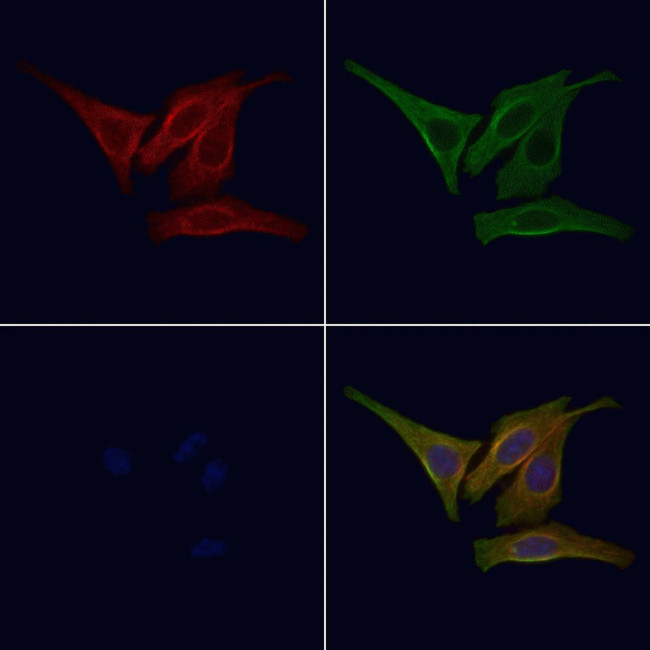 Phospho-EGFR (Tyr1092) Antibody in Immunocytochemistry (ICC/IF)