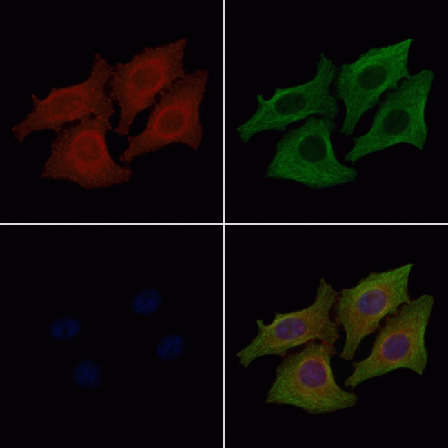 Phospho-EGFR (Tyr1110) Antibody in Immunocytochemistry (ICC/IF)