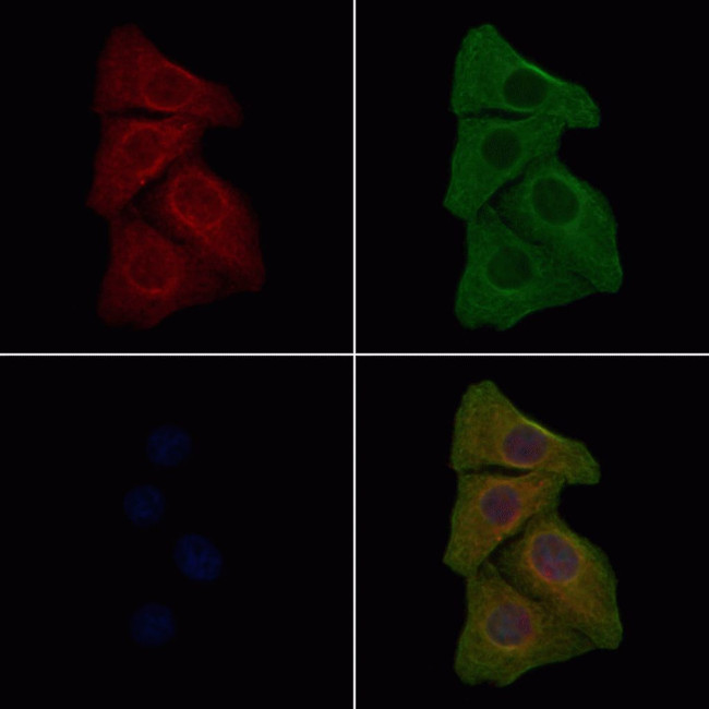 Phospho-EGFR (Tyr1172) Antibody in Immunocytochemistry (ICC/IF)