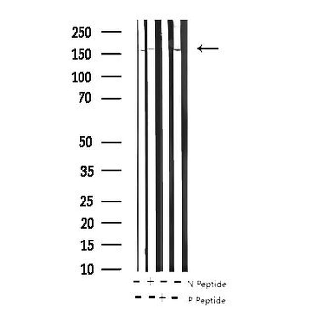 Phospho-EGFR (Tyr869) Antibody in Western Blot (WB)