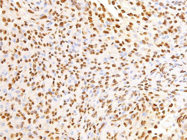 Phospho-EGFR (Ser695) Antibody in Immunohistochemistry (Paraffin) (IHC (P))