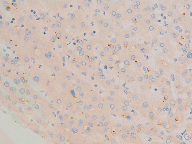 Phospho-c-Fos (Ser362) Antibody in Immunohistochemistry (Paraffin) (IHC (P))