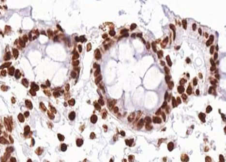 Phospho-C-RAF (Ser296) Antibody in Immunohistochemistry (Paraffin) (IHC (P))