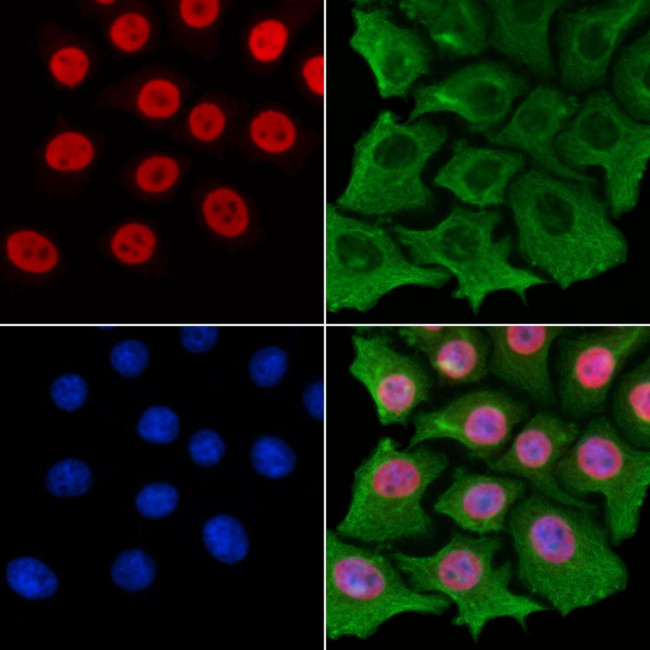 Phospho-C-RAF (Ser338) Antibody in Immunocytochemistry (ICC/IF)