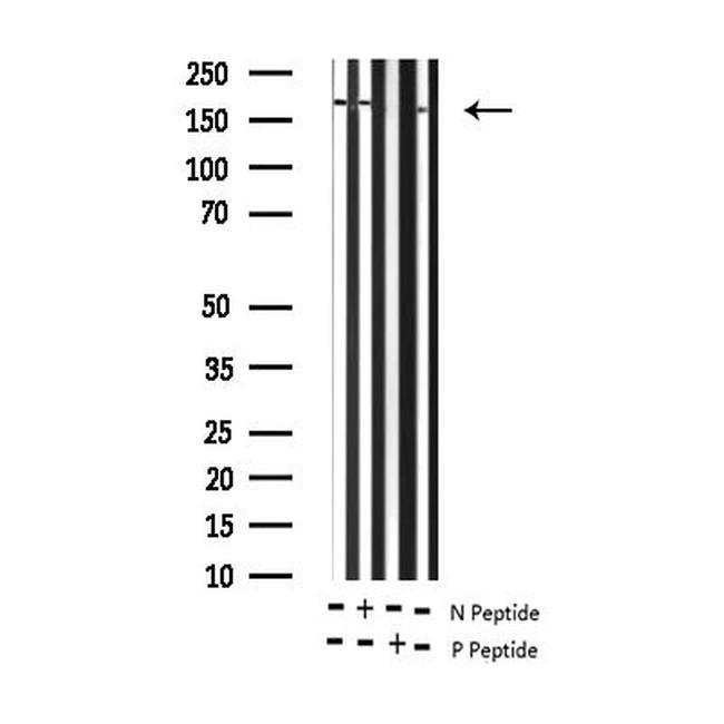 Phospho-ErbB2 (HER-2) (Tyr877) Antibody in Western Blot (WB)