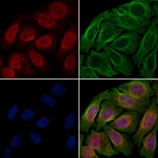 Phospho-p53 (Ser46) Antibody in Immunocytochemistry (ICC/IF)
