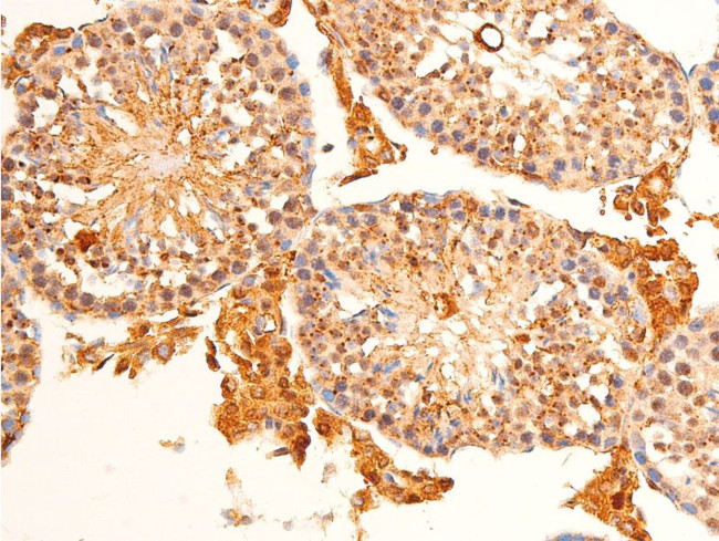 Phospho-c-Jun (Ser63) Antibody in Immunohistochemistry (Paraffin) (IHC (P))