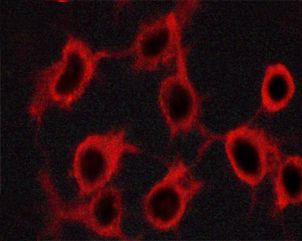 Phospho-Tyrosine Hydroxylase (Ser19) Antibody in Immunocytochemistry (ICC/IF)