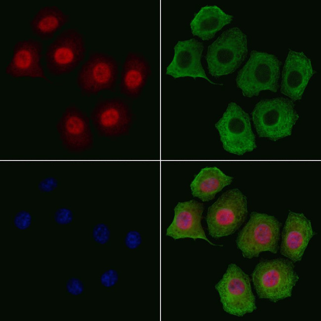 Phospho-Tyrosine Hydroxylase (Ser31) Antibody in Immunocytochemistry (ICC/IF)