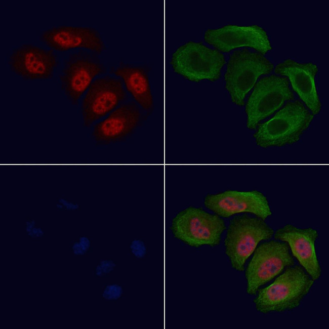 Phospho-Tyrosine Hydroxylase (Ser19) Antibody in Immunocytochemistry (ICC/IF)