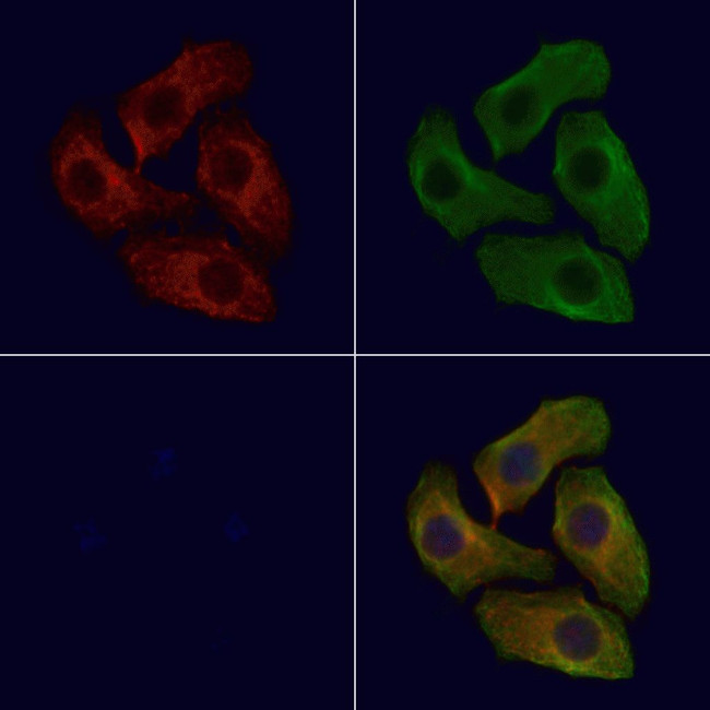 Phospho-IGF1R (Tyr1165, Tyr1166) Antibody in Immunocytochemistry (ICC/IF)
