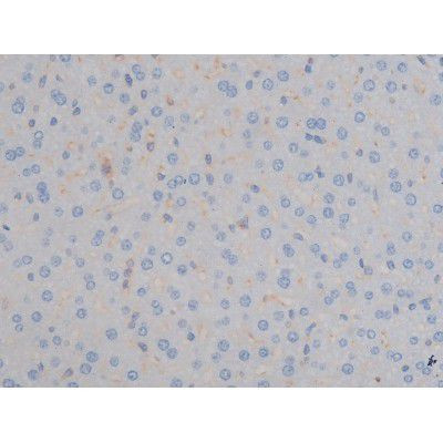 Phospho-IGF1R (Tyr1161) Antibody in Immunohistochemistry (Paraffin) (IHC (P))