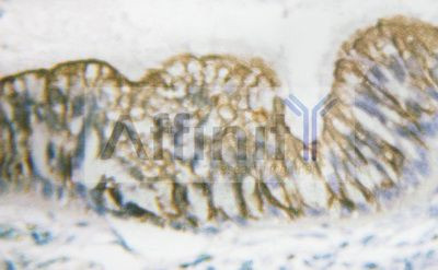 Phospho-PDGFRB (Tyr740) Antibody in Immunohistochemistry (IHC)