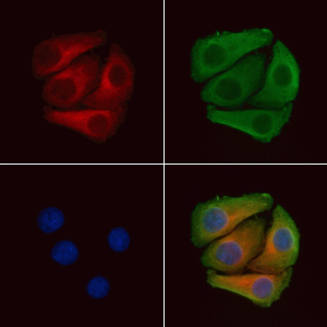 Phospho-PDGFRb (Tyr771) Antibody in Immunocytochemistry (ICC/IF)