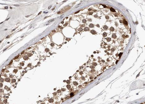 Phospho-Myb (Ser532) Antibody in Immunohistochemistry (Paraffin) (IHC (P))