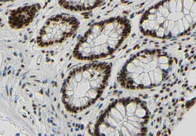 Phospho-BCL-2 (Ser87) Antibody in Immunohistochemistry (Paraffin) (IHC (P))
