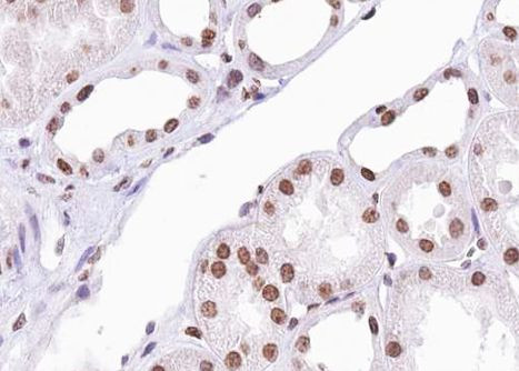 Phospho-ATF2 (Ser112, Ser94) Antibody in Immunohistochemistry (Paraffin) (IHC (P))