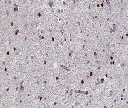 Phospho-RPA32 (Thr21) Antibody in Immunohistochemistry (Paraffin) (IHC (P))