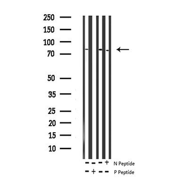 Phospho-CD44 (Ser706) Antibody in Western Blot (WB)