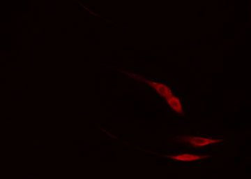 Phospho-PLCG2 (Tyr753) Antibody in Immunocytochemistry (ICC/IF)