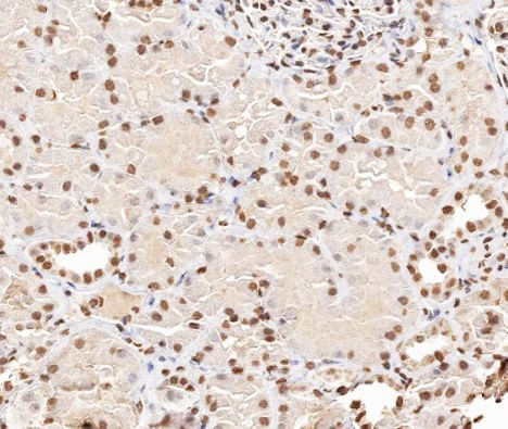 Phospho-Stathmin 1 (Ser38) Antibody in Immunohistochemistry (Paraffin) (IHC (P))