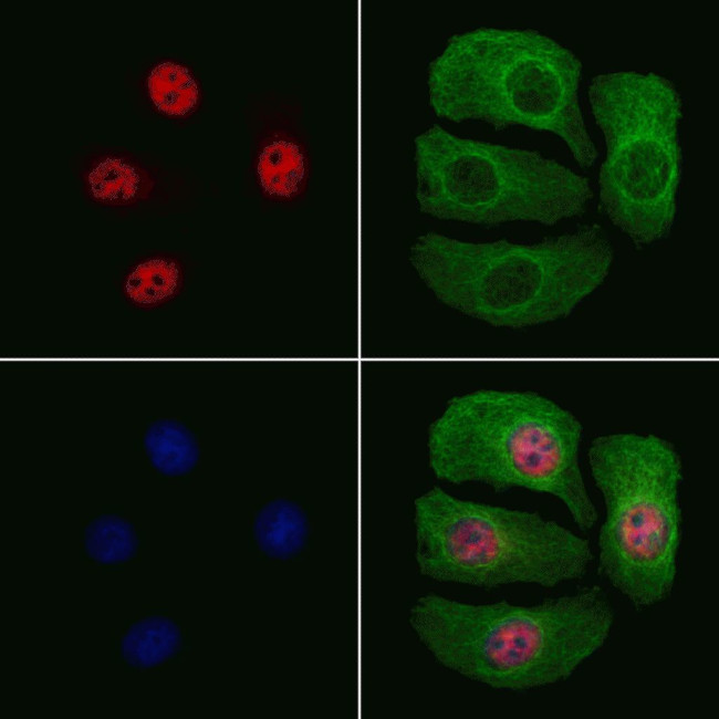 Phospho-JunB (Ser259) Antibody in Immunocytochemistry (ICC/IF)
