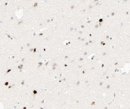 Phospho-C/EBP beta (Thr235, Thr188) Antibody in Immunohistochemistry (Paraffin) (IHC (P))