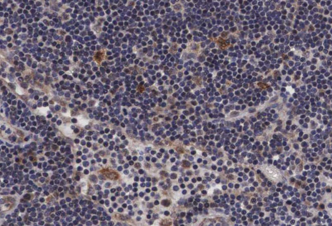 Phospho-PTP1B (Ser50) Antibody in Immunohistochemistry (Paraffin) (IHC (P))