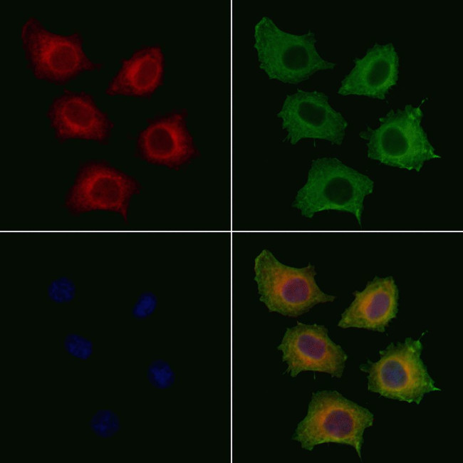 Phospho-PLCG1 (Tyr771) Antibody in Immunocytochemistry (ICC/IF)