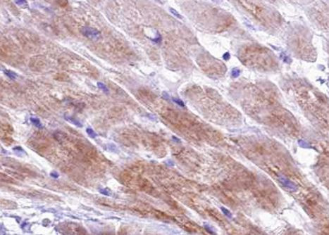 Phospho-Cardiac Troponin I (Ser44) Antibody in Immunohistochemistry (Paraffin) (IHC (P))