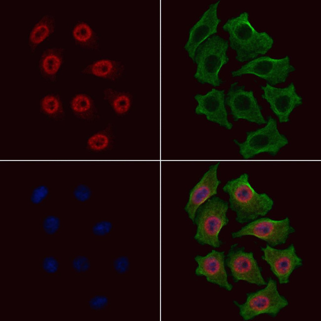 Phospho-p70 S6 Kinase (Ser447) Antibody in Immunocytochemistry (ICC/IF)