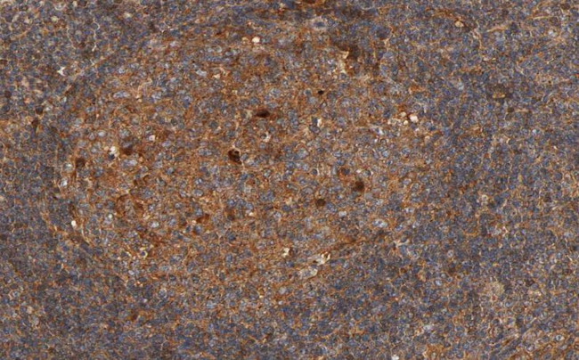Phospho-p70 S6 Kinase (Thr444) Antibody in Immunohistochemistry (Paraffin) (IHC (P))