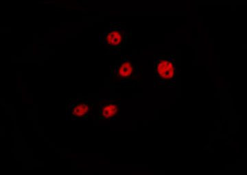 Phospho-Cyclin D1 (Ser90) Antibody in Immunocytochemistry (ICC/IF)