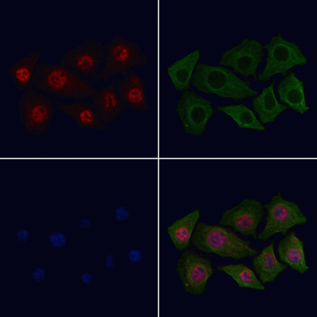 Phospho-CDK2 (Thr160) Antibody in Immunocytochemistry (ICC/IF)