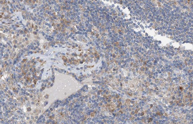 Phospho-Shc (Tyr349) Antibody in Immunohistochemistry (Paraffin) (IHC (P))
