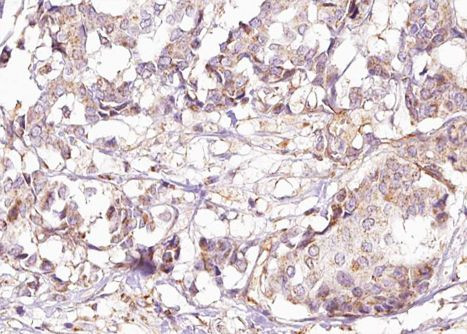 Phospho-Shc (Tyr427) Antibody in Immunohistochemistry (Paraffin) (IHC (P))