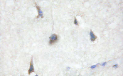 Phospho-Cdc25B (Ser353) Antibody in Immunohistochemistry (Paraffin) (IHC (P))