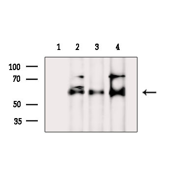 Phospho-AKT1 (Ser129) Antibody in Western Blot (WB)