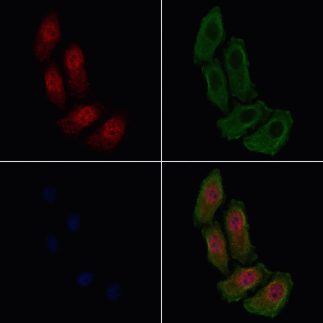 Phospho-beta Catenin (Ser33) Antibody in Immunocytochemistry (ICC/IF)