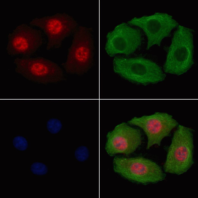 Phospho-beta Catenin (Thr41, Ser45) Antibody in Immunocytochemistry (ICC/IF)
