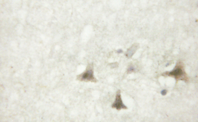 Phospho-beta Catenin (Tyr489) Antibody in Immunohistochemistry (Paraffin) (IHC (P))