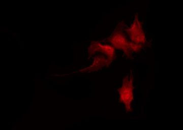 Phospho-alpha Adducin (Ser726) Antibody in Immunocytochemistry (ICC/IF)