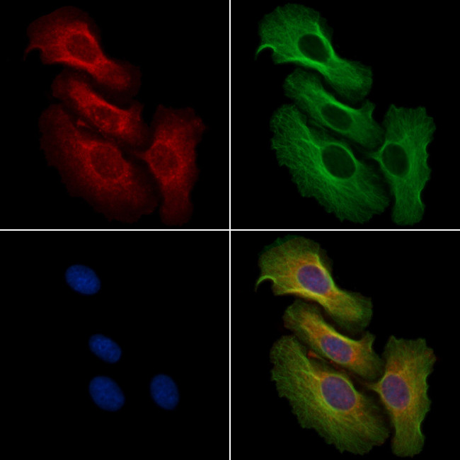 Phospho-MEK2 (Thr394) Antibody in Immunocytochemistry (ICC/IF)