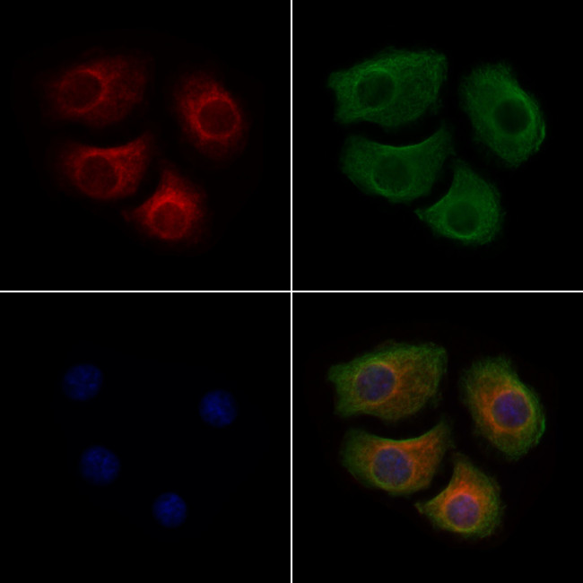 Phospho-Alpha-synuclein (Tyr133) Antibody in Immunocytochemistry (ICC/IF)